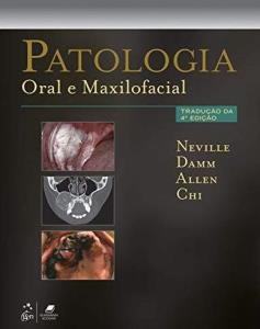 Patologia Oral e Maxilofacial